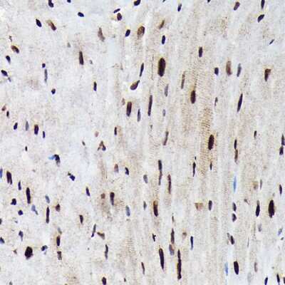 Immunohistochemistry-Paraffin: FOXO3 [p Ser425] Antibody - Azide and BSA Free [NBP3-16945]